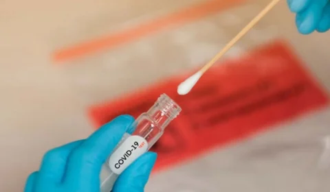 Boletim Covid-19: AM registra 200 novos casos e 1 morte nesta segunda, 20