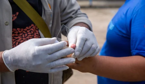 Casos de malária em Roraima caem 43% em 2025