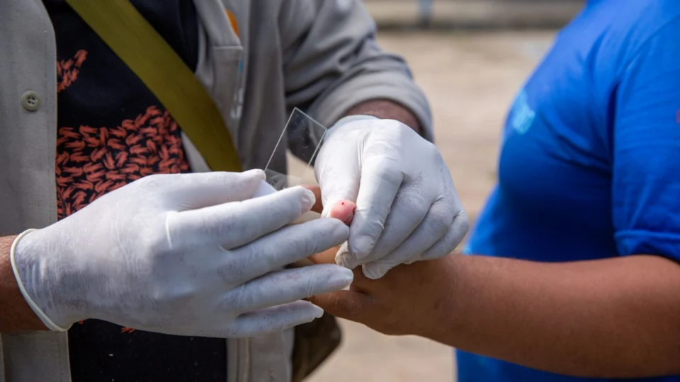 Casos de malária em Roraima caem 43% em 2025