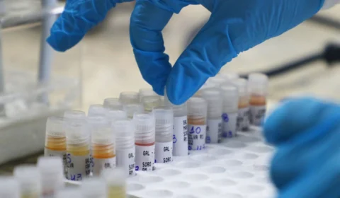 Mpox: Amazonas contabiliza 352 casos confirmados da Varíola Símia