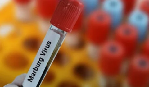 Marburg: mais um país confirma surto do vírus, um dos mais letais do mundo