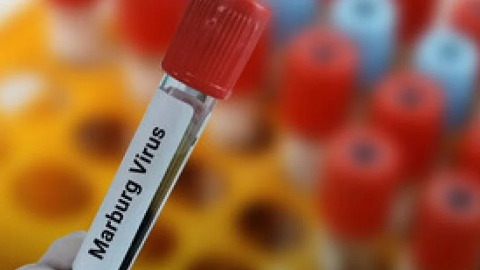 Marburg: mais um país confirma surto do vírus, um dos mais letais do mundo