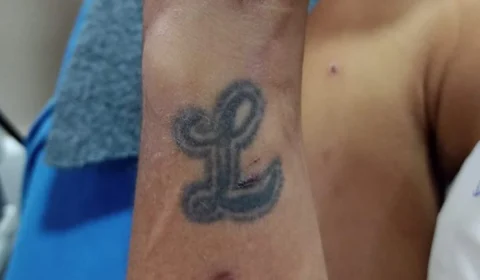 Após ser atropelado por moto, homem internado em hospital procura família no AM