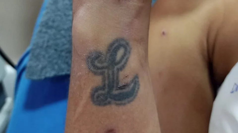 Após ser atropelado por moto, homem internado em hospital procura família no AM