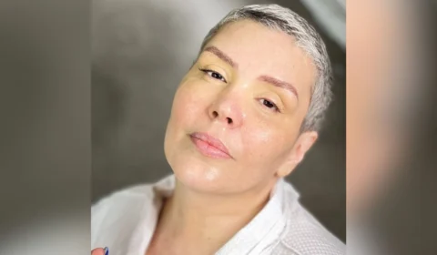 Cantora Simony retoma tratamento contra câncer de intestino grosso