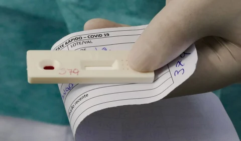 Boletim Covid-19: Amazonas registra 141 novos casos em uma semana