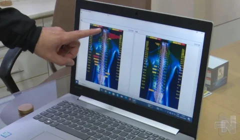 Saiba quais são os benefícios da quiropraxia a curto e longo prazo; veja vídeo