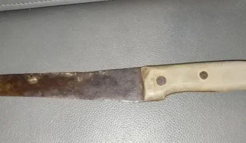 Mulher fere mão de marido com faca durante briga em Rorainópolis-RR