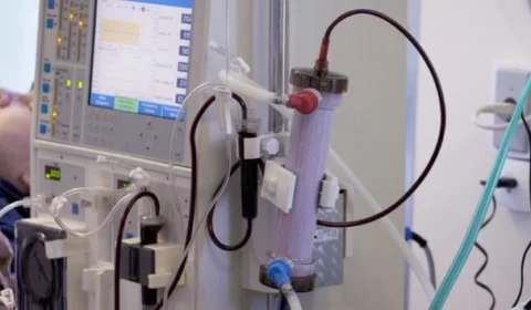 SUS: R$ 200 milhões são destinados para serviços de hemodiálise no Brasil