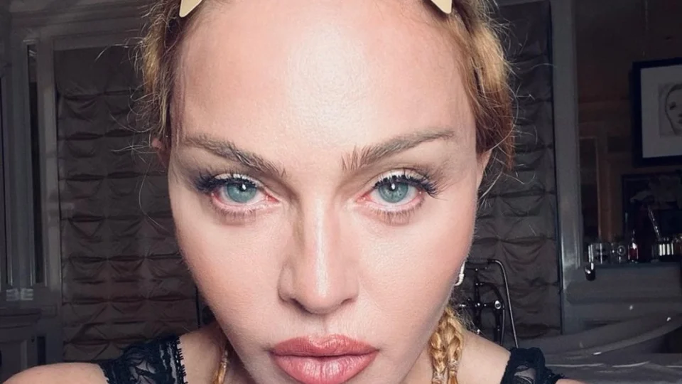 Madonna está internada em UTI com grave infecção, diz agente da cantora