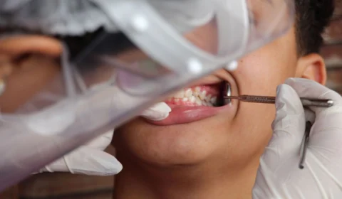 Equipes de saúde bucal vão receber bônus de desempenho no Brasil, diz Saúde