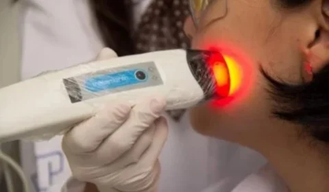 SUS deve adotar tecnologia que remove 93% dos tumores do câncer de pele