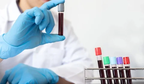 SUS ofertará testes para detectar gonorreia e clamídia para combater ISTs