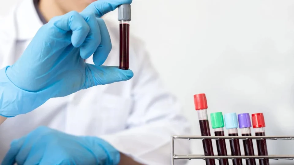 SUS ofertará testes para detectar gonorreia e clamídia para combater ISTs