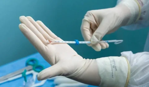 DIU: Manaus amplia acesso ao dispositivo em unidades de saúde