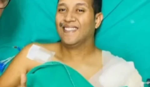 Motociclista que teve perna decepada em acidente recebe alta no AC