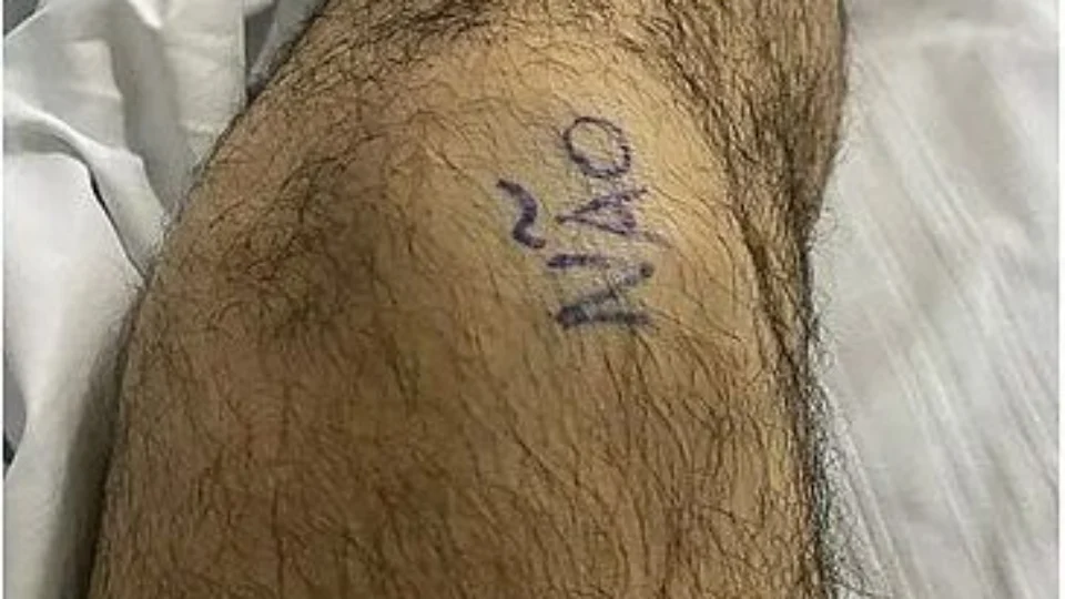 Paciente escreve ‘sim’ e ‘não’ nos joelhos para marcar antes de cirurgia