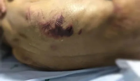 Pastores são suspeitos de torturar pacientes em clínica clandestina em GO