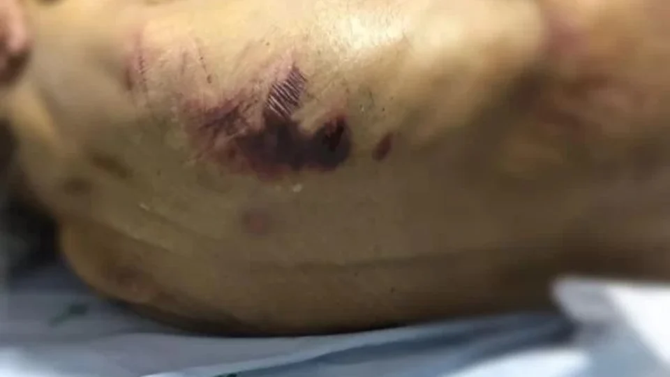 Pastores são suspeitos de torturar pacientes em clínica clandestina em GO