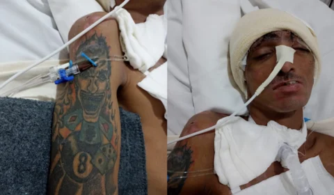 HPS João Lúcio procura familiares de paciente vítima de agressão física