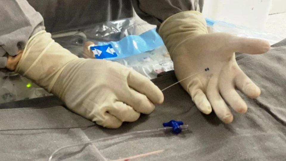 Bebê prematuro realiza procedimento cardíaco inovador no Tocantins