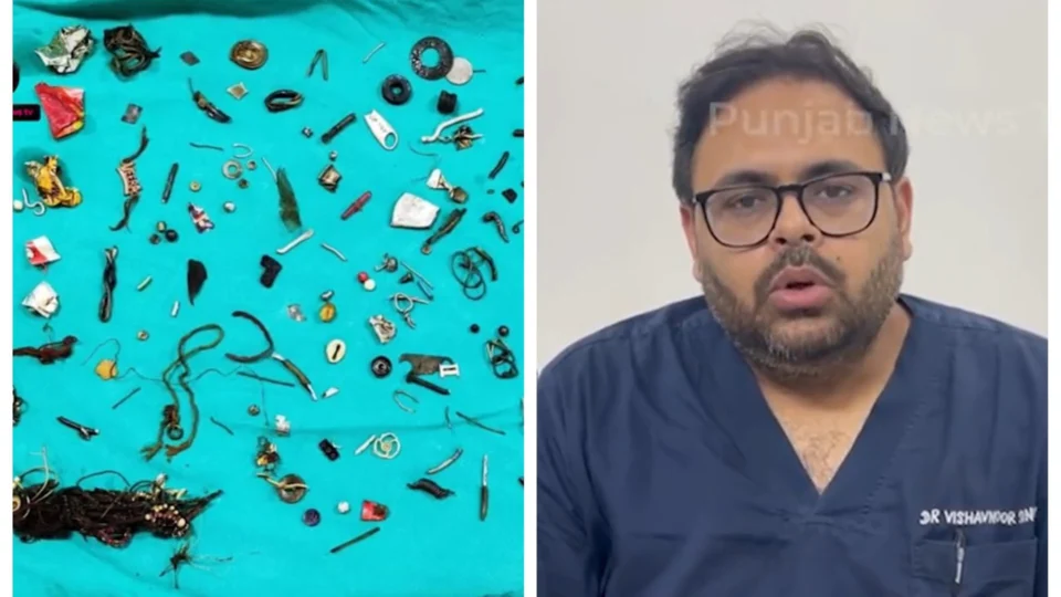 VÍDEO: médicos encontram 60 objetos em estômago de homem na Índia