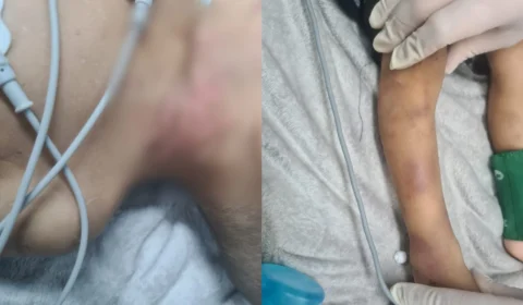 Criança de 2 anos morre após ser espancada por tios em Manaus