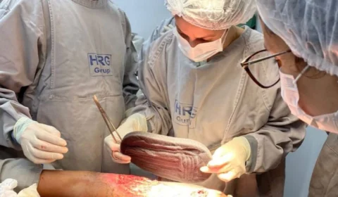 TO: HRG adere técnica inovadora para tratar feridas de difícil cicatrização