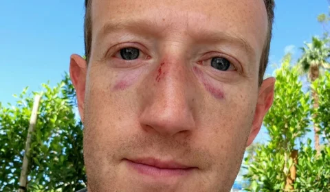 Mark Zuckerberg publica foto com hematomas no rosto no Instagram