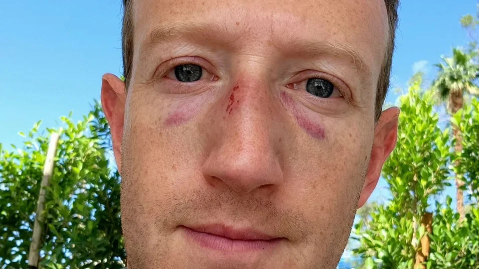 Mark Zuckerberg publica foto com hematomas no rosto no Instagram