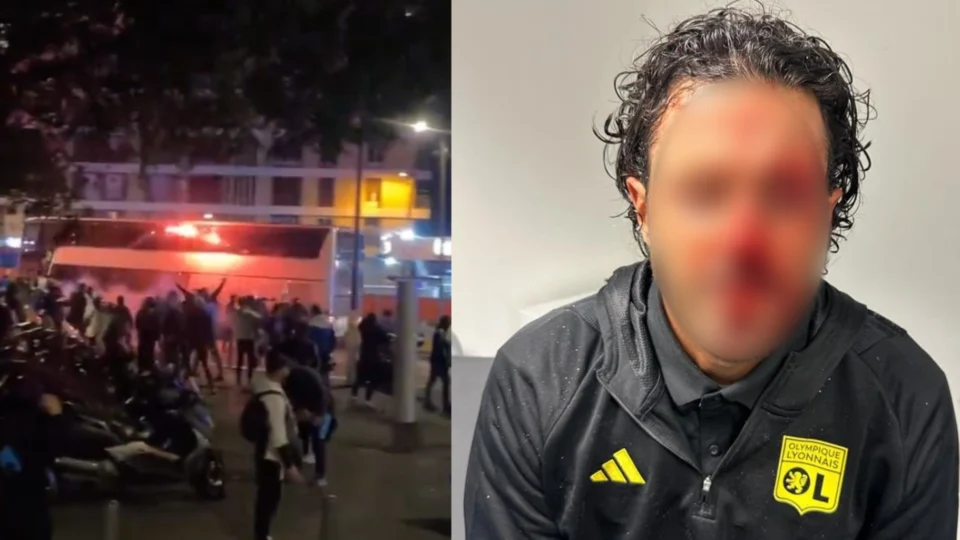 VÍDEO: ônibus do Lyon é apedrejado na França; técnico foi atingido 