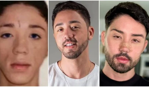 Antes e depois de Rico Melquíades surpreende internautas; confira