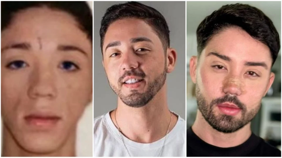 Antes e depois de Rico Melquíades surpreende internautas; confira