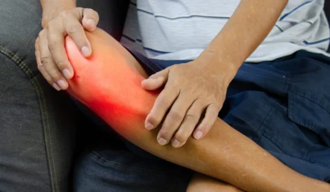 AM tem 88 notificações de rabdomiólise; 57 casos são confirmados