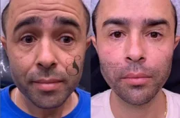 Influencer? Motorista que atropelou Kayky Brito tem contato para ‘publis’