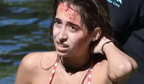 Jovem sobrevive após ser mordida na cabeça por crocodilo de 3 metros nos EUA