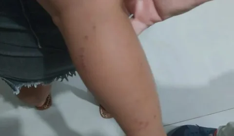 VÍDEO: sucuri de quase 6 metros é morta ao atacar criança em Goiás