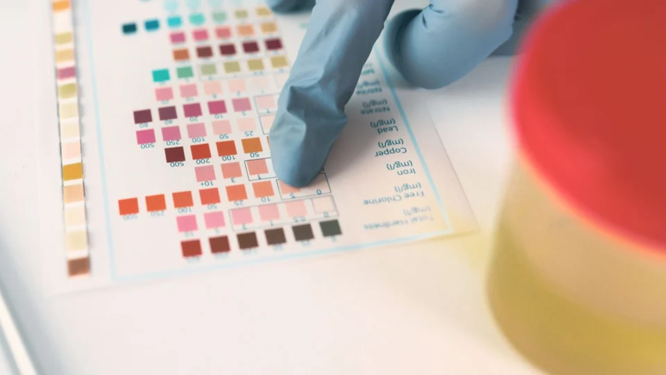 AM tem 102 notificações de rabdomiólise; 68 casos são confirmados