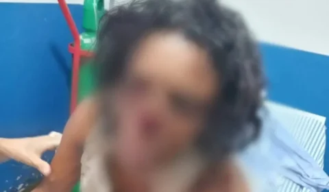 Mulher perde nariz em tentativa de feminicídio em Colmeia-TO