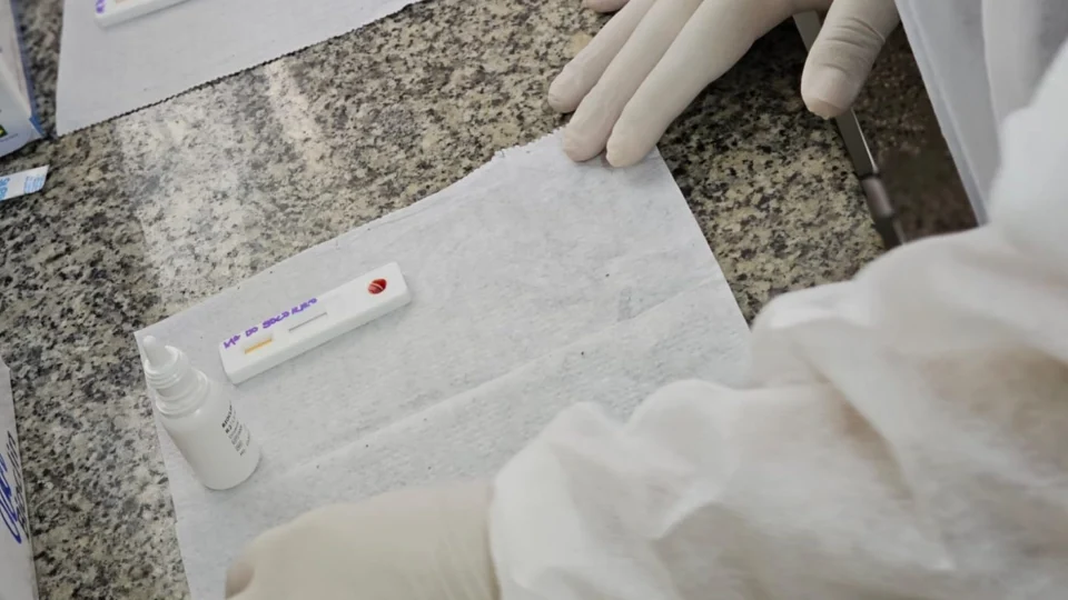 Teste rápido para detectar anticorpos da hanseníase é ofertado em Manaus