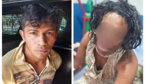 Após arrancar parte do nariz da esposa, homem é indiciado em Colméia-TO