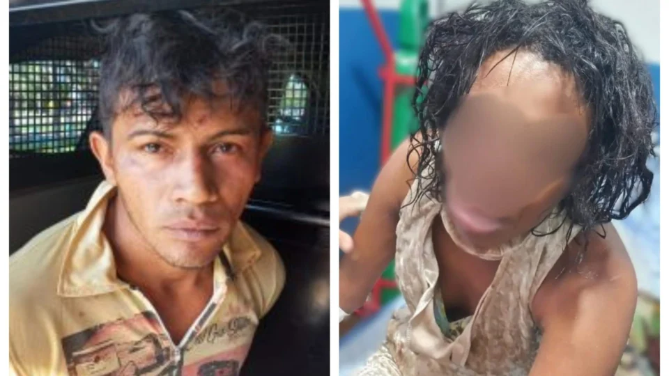 Após arrancar parte do nariz da esposa, homem é indiciado em Colméia-TO