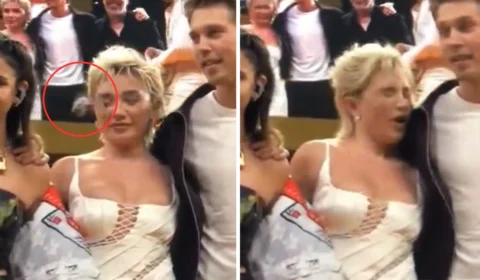 VÍDEO: atriz é atingida com pulseira no rosto durante CCXP