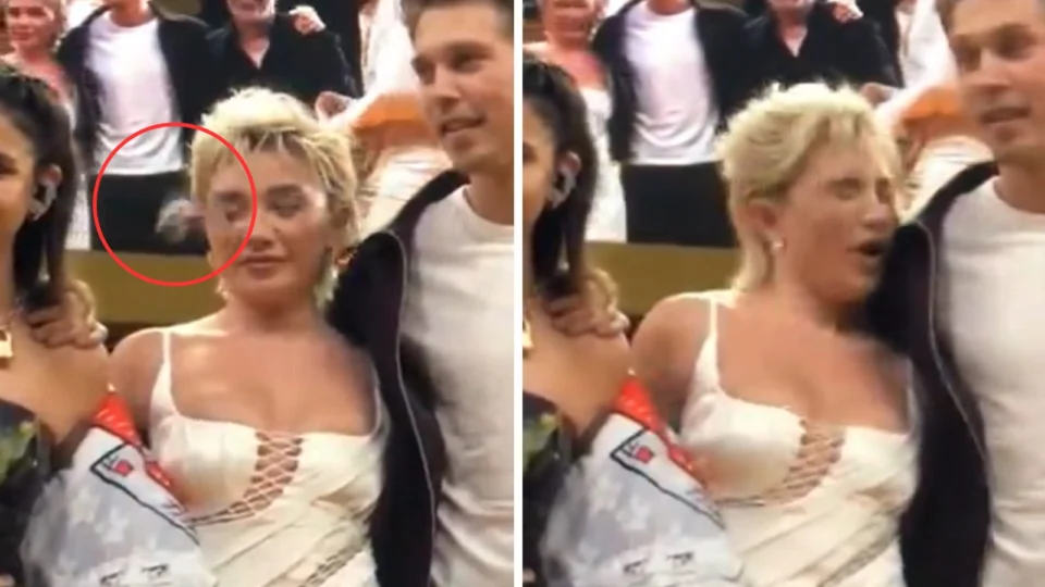 VÍDEO: atriz é atingida com pulseira no rosto durante CCXP