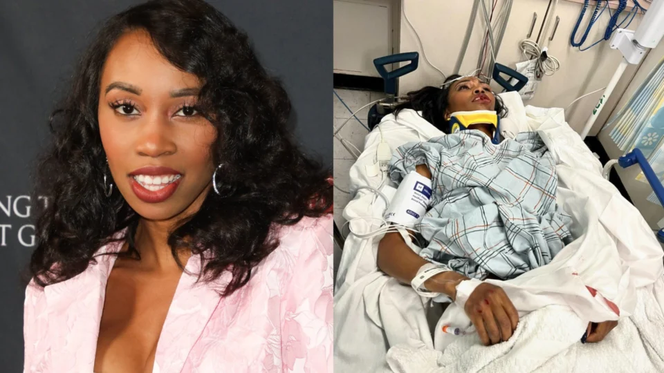 Atriz da Marvel sofre grave acidente e fica desfigurada nos EUA