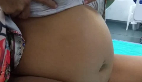 Mulher com bebê morto na barriga denuncia falta de atendimento na Maternidade em RR