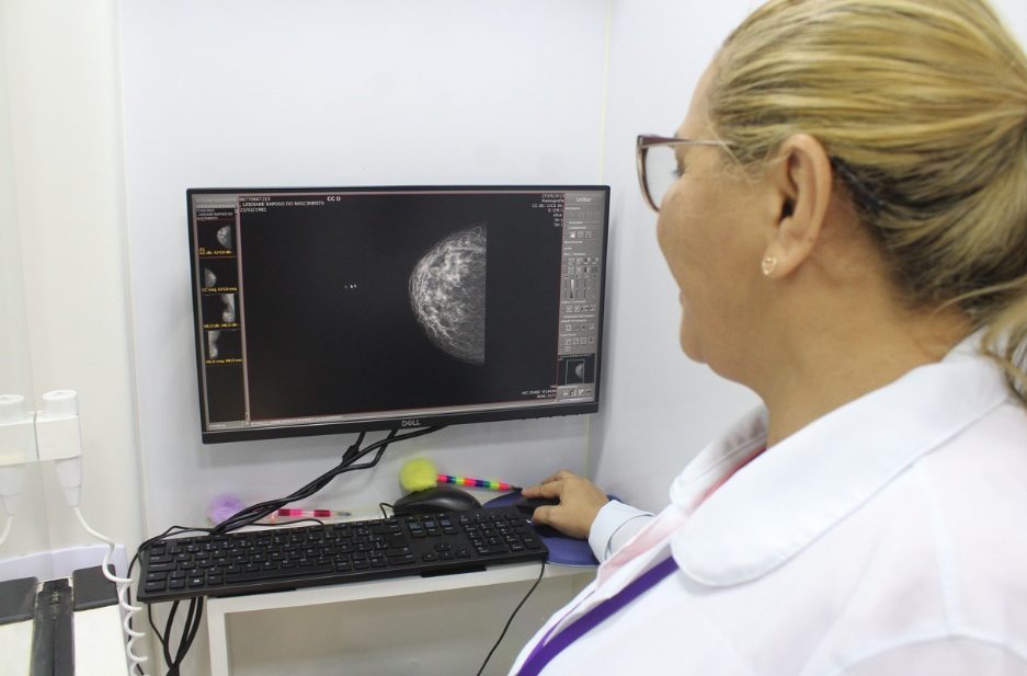 Mamografia é um dos serviços ofertados - Foto: Secom-RR