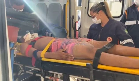 Jovem colide em poste e vai para PS com fratura na mandíbula no AC