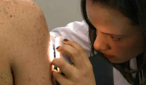 Grupo Bringel participa de atendimento dermatológico pioneiro em Manaquiri-AM