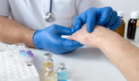 Pessoas com Lúpus tem atendimento preferencial no Amazonas